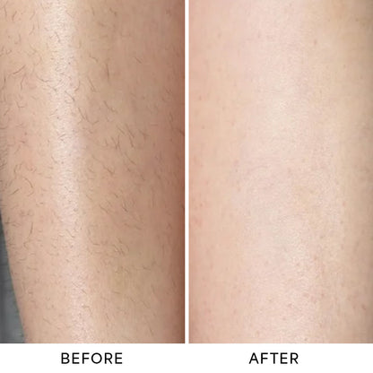 Monvy™ Trimmer 2.0