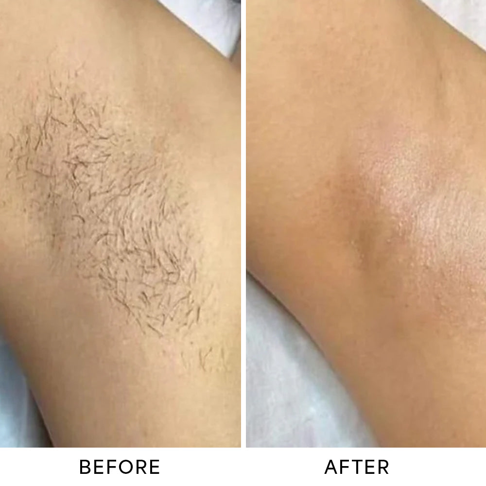 Monvy™ Trimmer 2.0