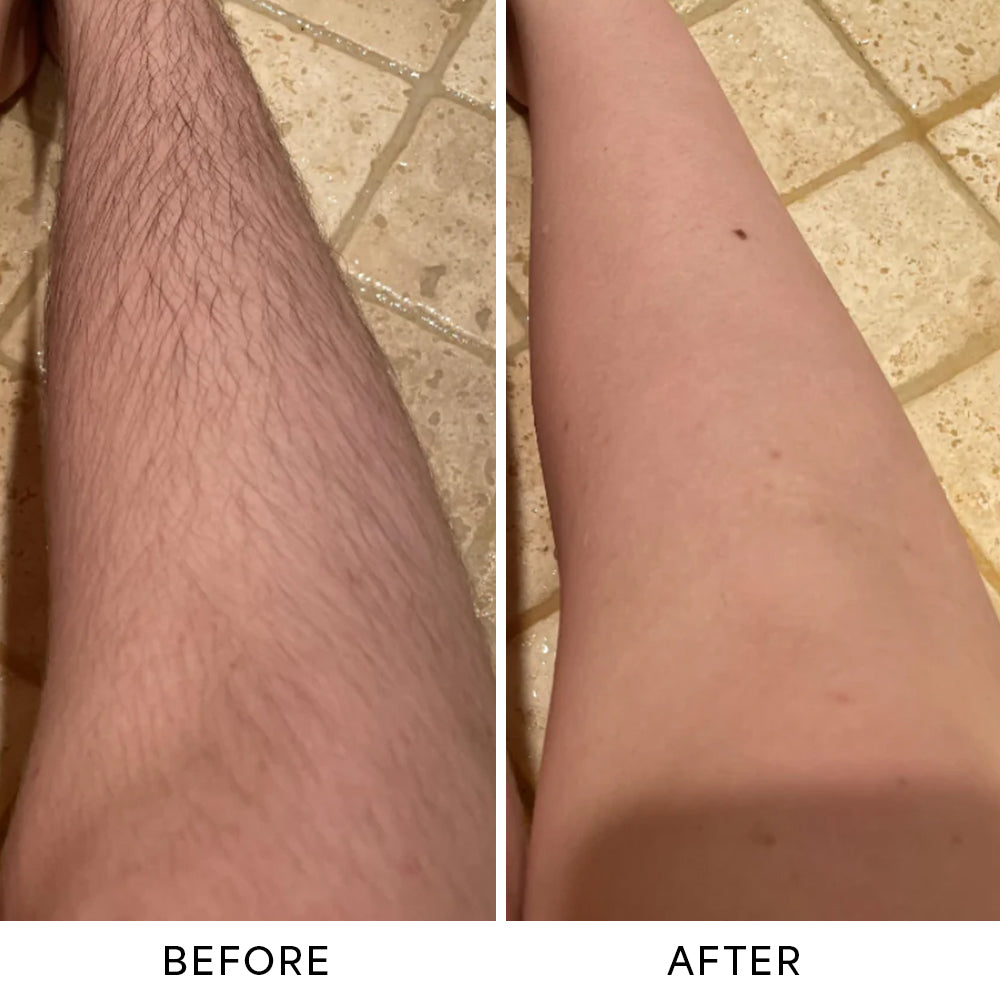 Monvy™ Trimmer 2.0
