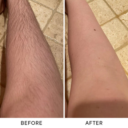 Monvy™ Trimmer 2.0